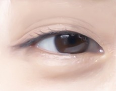 눈썹거상술 STEP 01