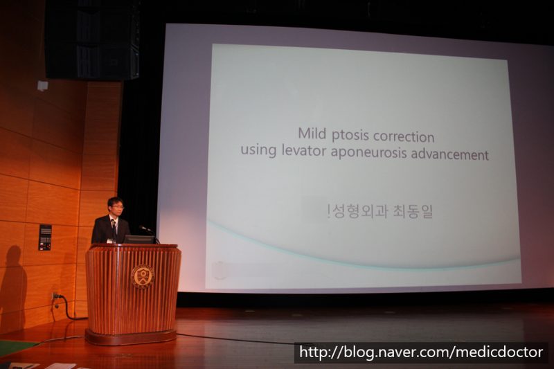 절개 눈매교정 수술시연 제17회 세브란스 심포지엄