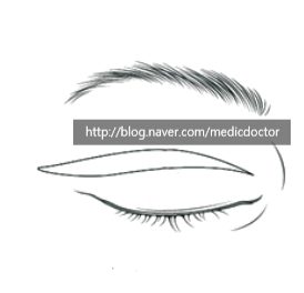 상안검하안검 수술 동시에 한다면?