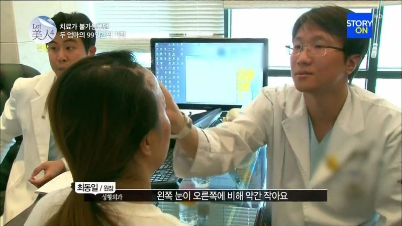 렛미인 성형외과 의사로 출연 했을 때 - 눈성형 쌍꺼풀