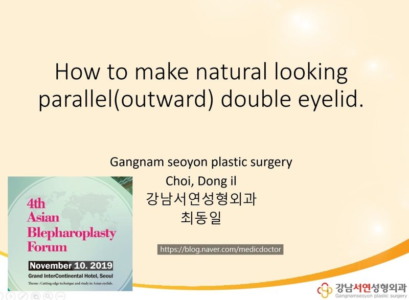 자연스러운 아웃라인 쌍꺼풀 만들기 발표 ㅡ 아시안 눈성형포럼 2019