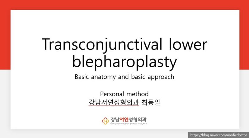 눈밑지방 재배치 통증 덜하게 하려면?