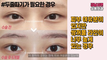 두줄따기 제대로 알아보자