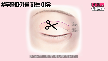 두줄따기 설명 도해
