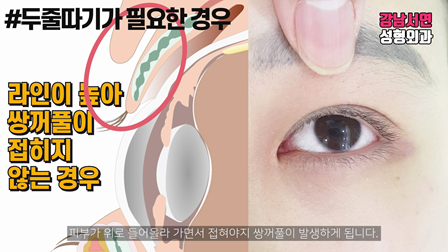 두줄따기 설명 도해