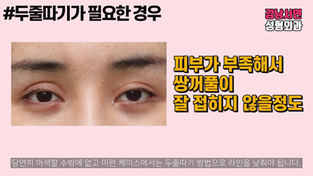 두줄따기 설명 도해