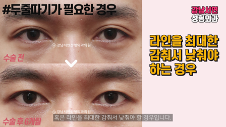 두줄따기 설명 도해