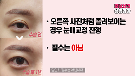 두줄따기 설명 도해