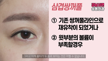 두줄따기 설명 도해