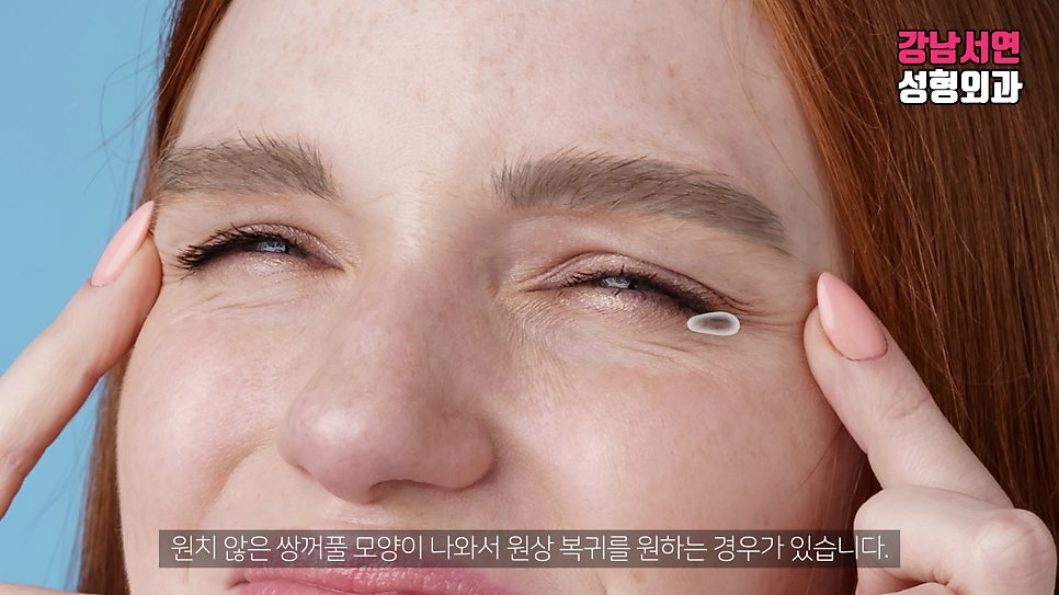 매몰실풀기 관련 이미지