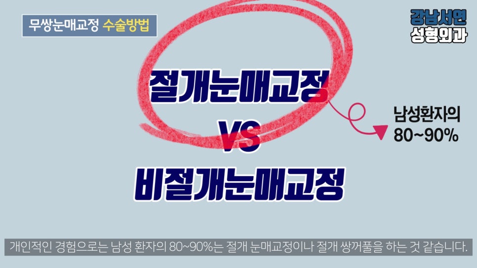 남자 눈성형 설명 도해