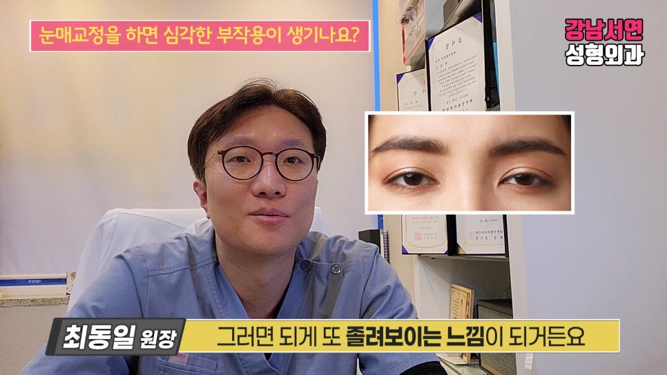 쌍꺼풀 재수술 설명 영상 화면