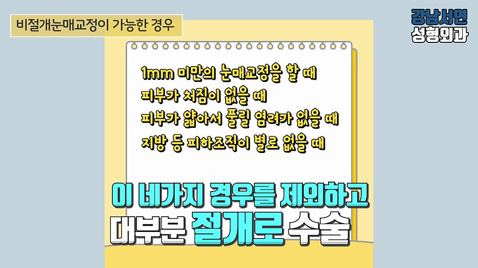 남자 눈성형 설명 도해