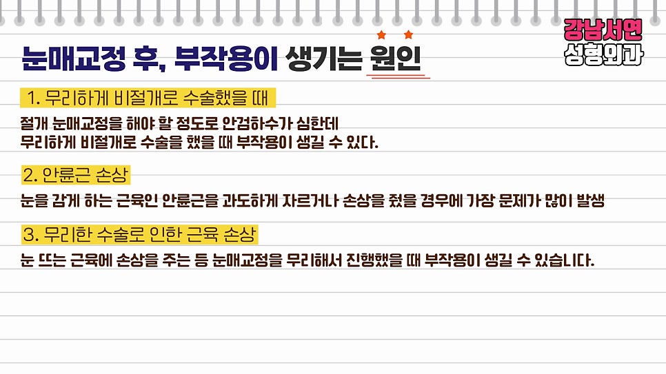 눈매교정 설명 도해
