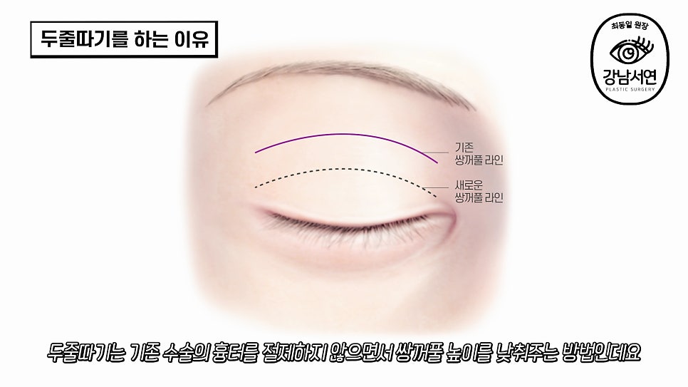 두줄따기 설명 도해
