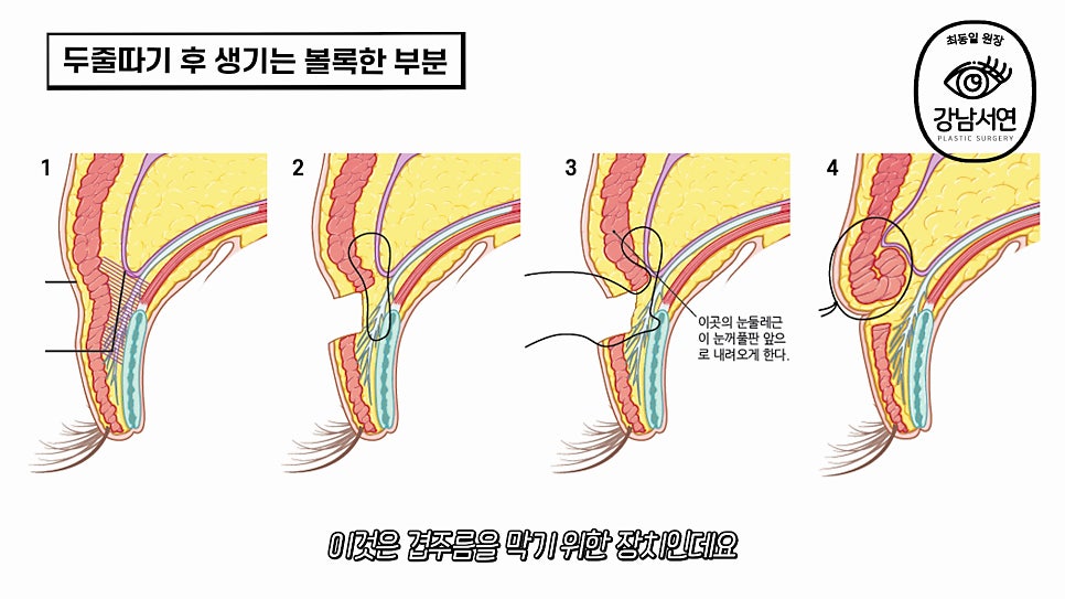 두줄따기 설명 도해
