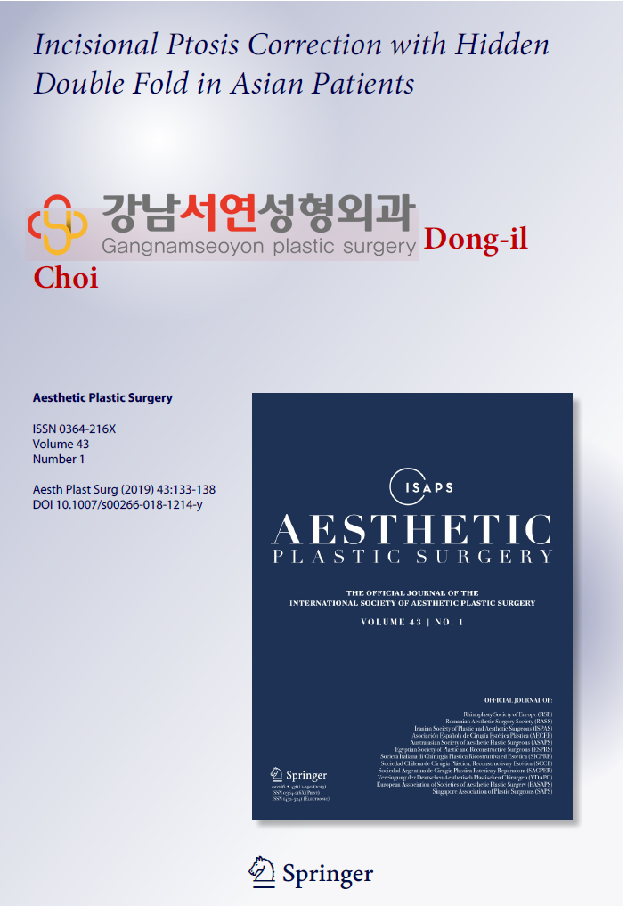 최동일 원장 학술 논문 — 남자 눈성형