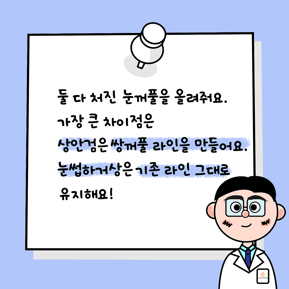 상안검성형 설명 도해