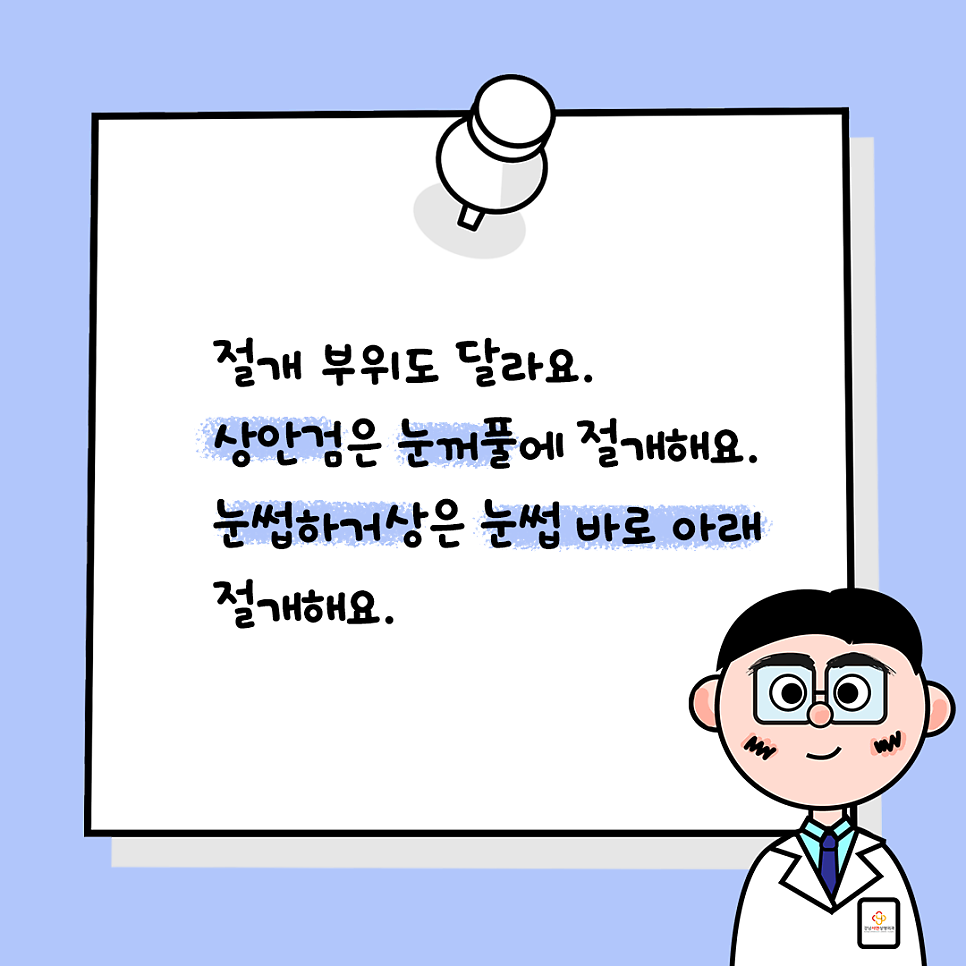 상안검성형 설명 도해