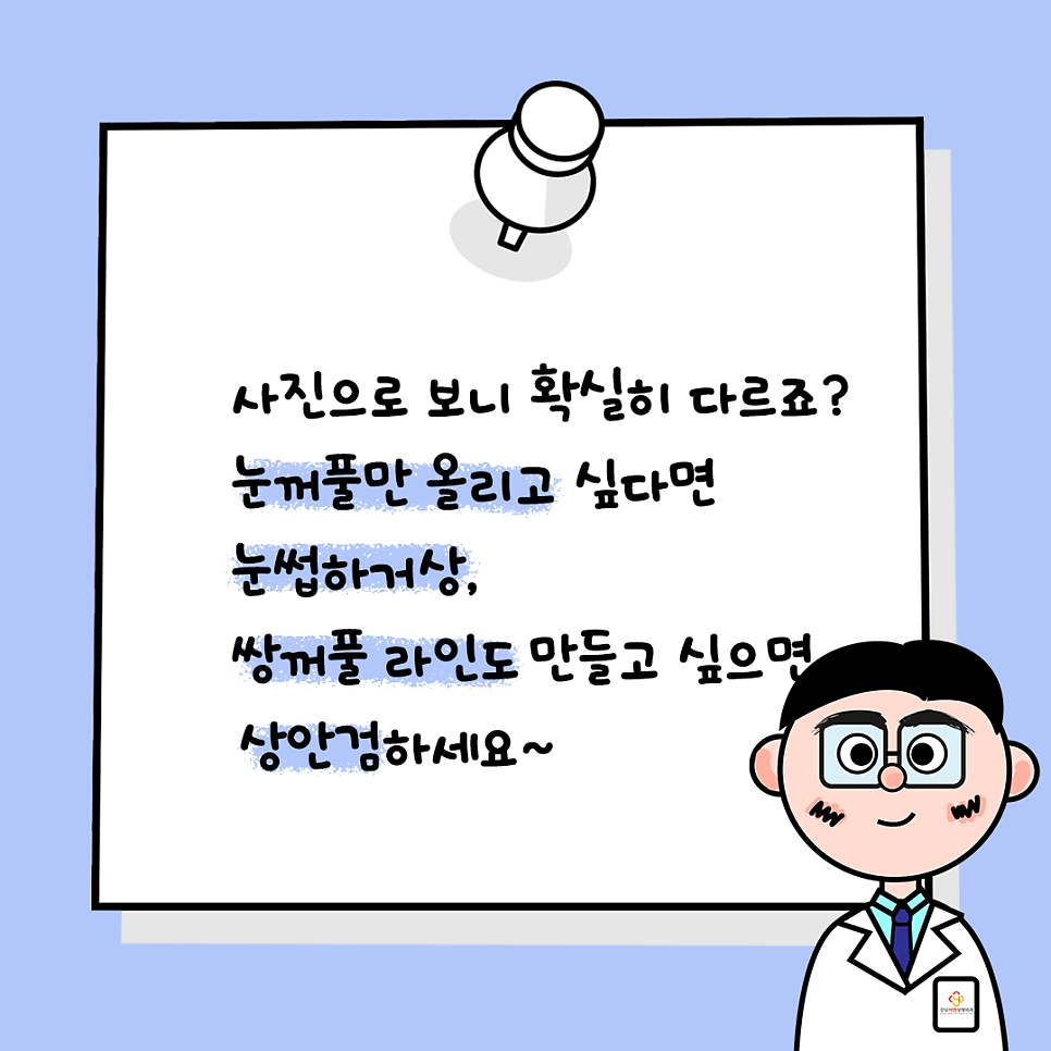 상안검성형 설명 도해