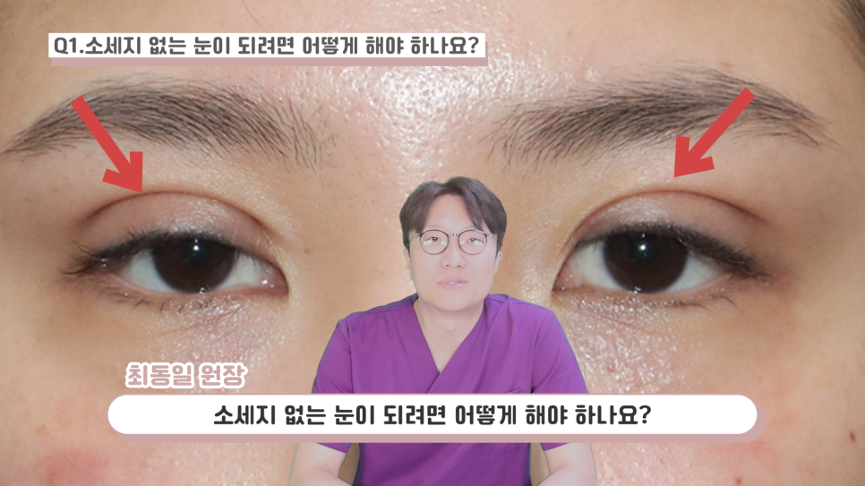 눈성형 설명 영상 화면