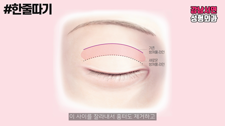두줄따기 설명 도해