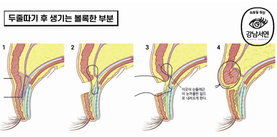 두줄따기 설명 도해