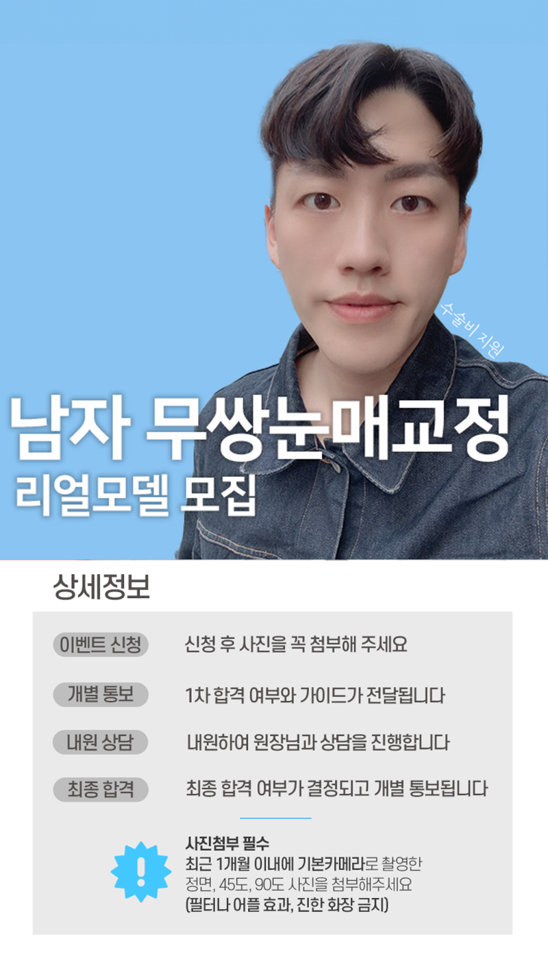 남자 눈성형 안내 이미지