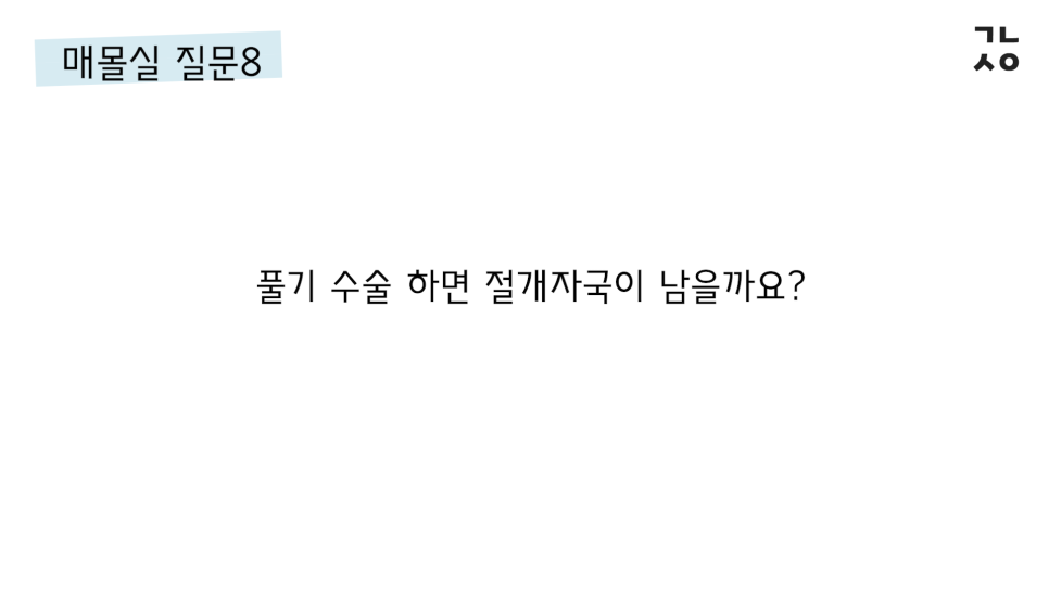매몰실풀기 자주 묻는 질문