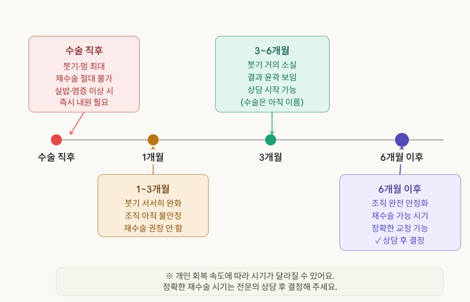 쌍꺼풀 재수술 설명 도해