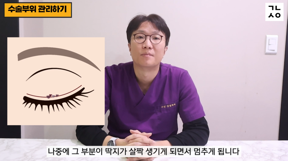 눈성형 설명 영상 화면