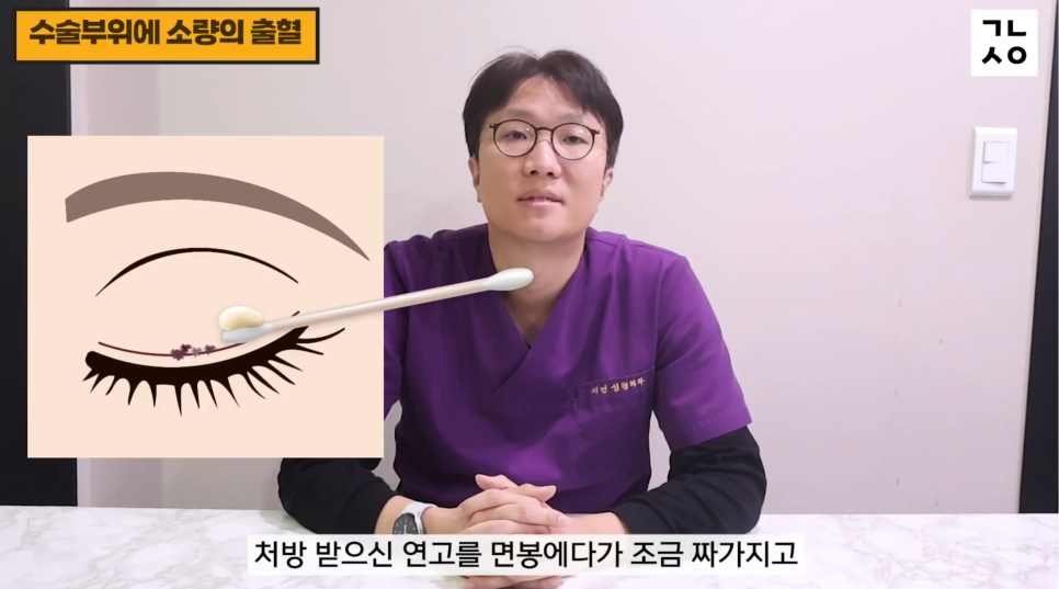 눈성형 설명 영상 화면