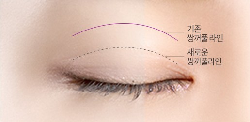 두줄 따기 — 기존 라인 아래 새 라인을 잡는 모식도