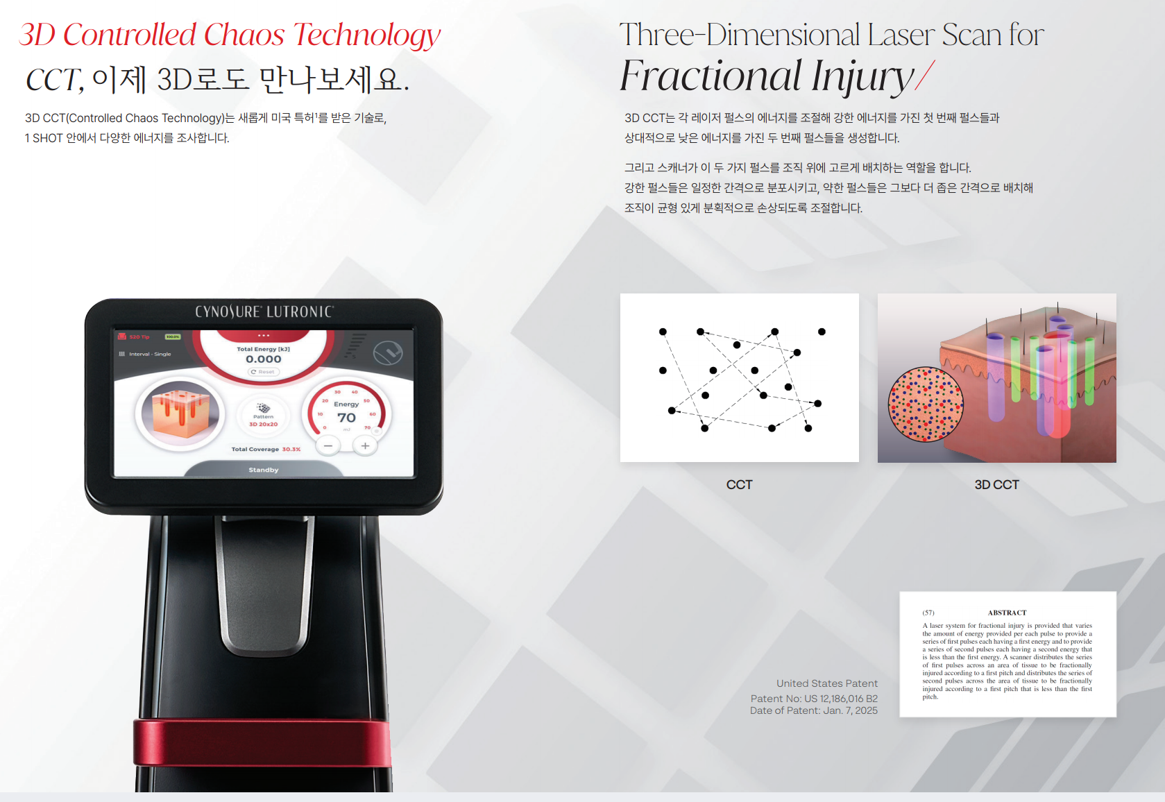 Variable-depth fractional laser scan pattern — OCT image