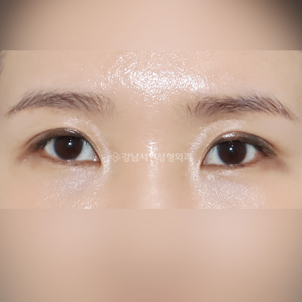 라인높이기 AFTER
